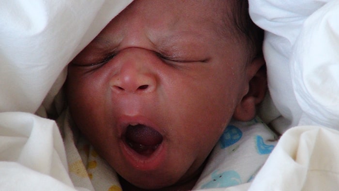 Infant yawning