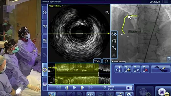 Master class in precision PCI with Drs. Allen Jeremias & Ziad Ali, utilizing the brand new OmniWire