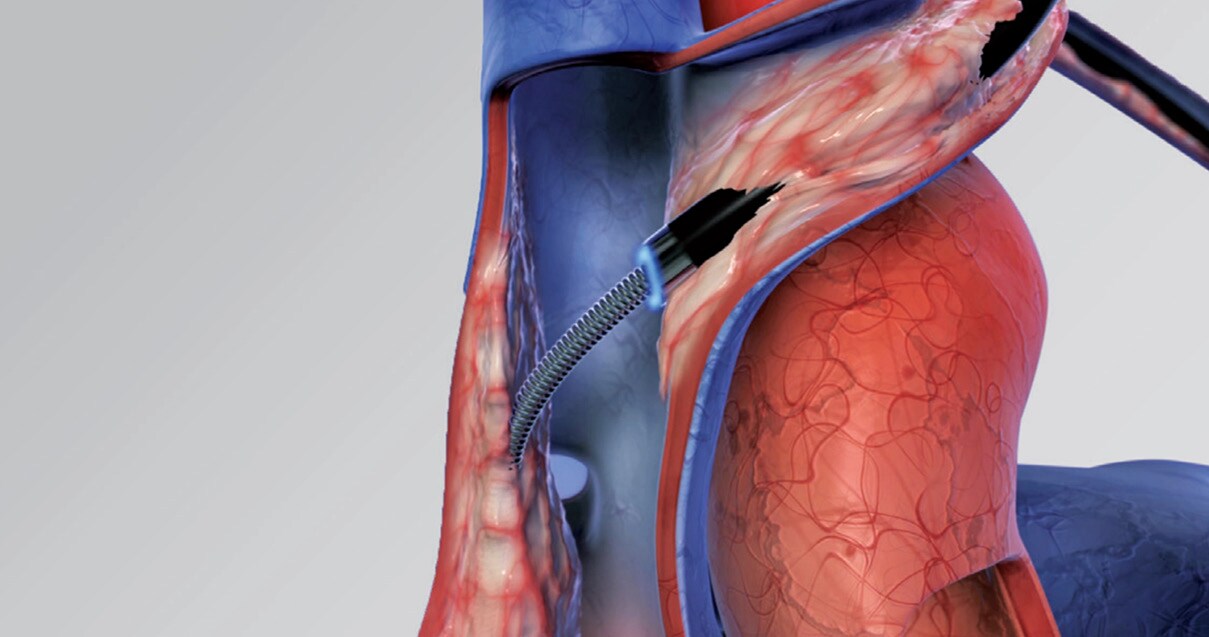 Artery animation