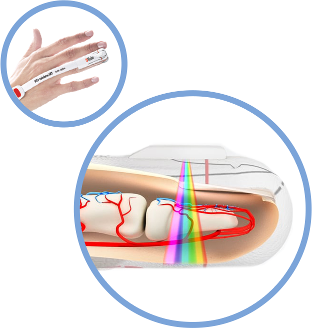 Masimo rainbow SET™ enhance Phillips lntelliVue patient monitors