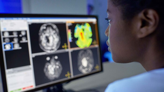 MR Neuro Imaging