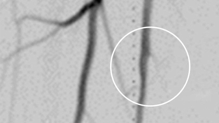 Angiography visual