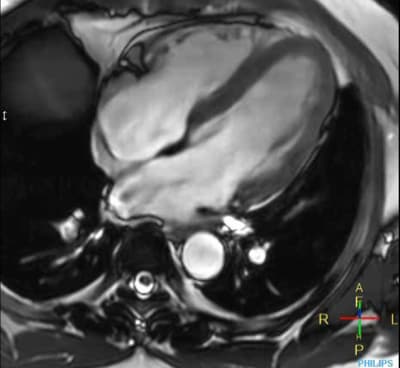 PHH philips smartspeed cardiac imaging