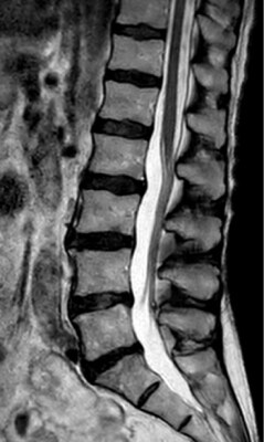 PHH philips smartspeed spine imaging