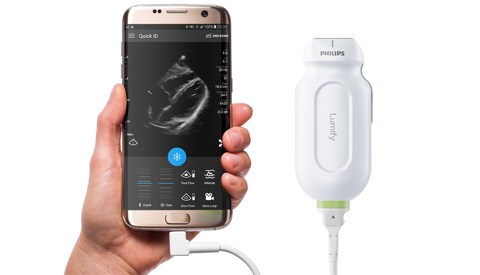 lumify portable ultrasound