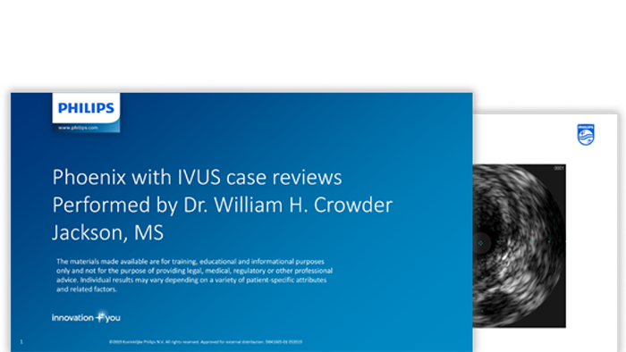 crowder ivus case review download (.pdf) file