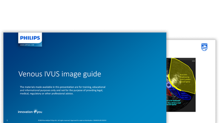venous IVUS images download (.pdf) file