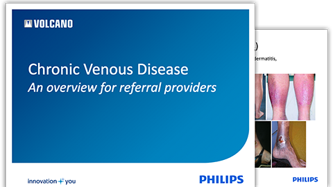 chronic venous insufficiency overview download (.pdf) file