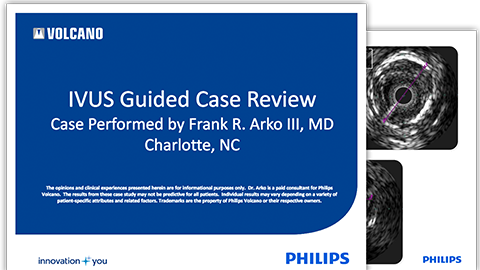 ivus guided case review download (.pdf) file