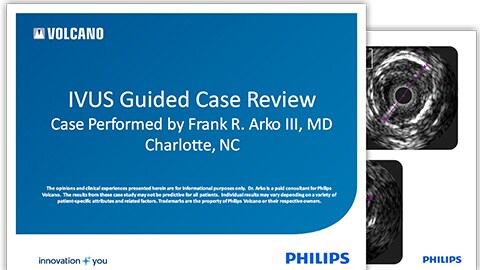 ivus guided case review download (.pdf) file