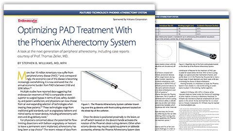 optimizing pad treatment download (.pdf) file