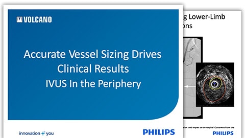 stent size matters in the SFA download (.pdf) file