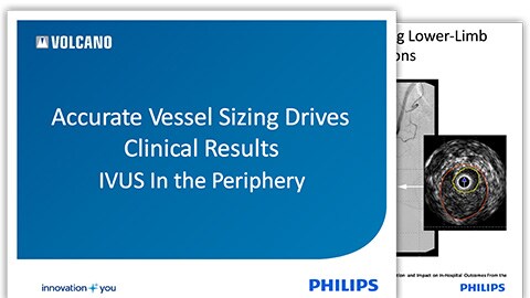 stent size matters in the SFA download (.pdf) file