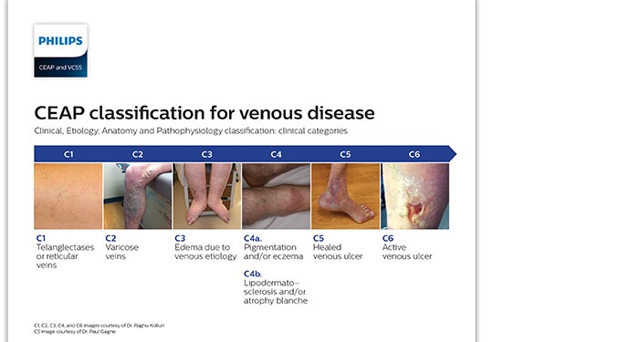 patient posters and flyers download (.pdf) file