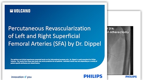 dippel case review download (.pdf) file