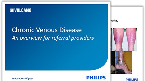 chronic venous disease overview download (.pdf) file