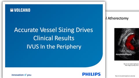accurate vessel sizing clinical presentation download (.pdf) file