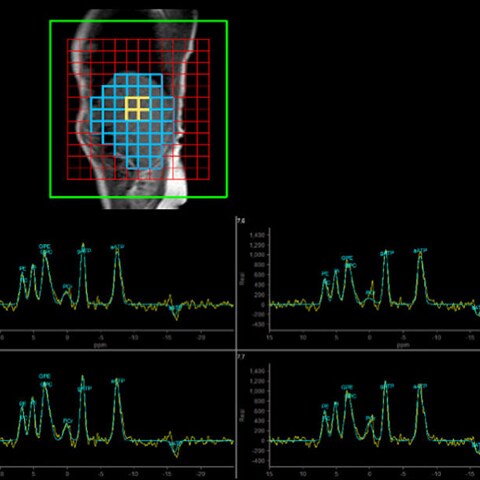 Imaging for metabolic diseases