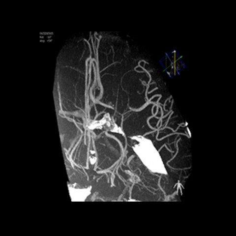 Musculoskeletal imaging