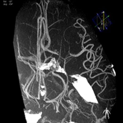 Neurologic imaging