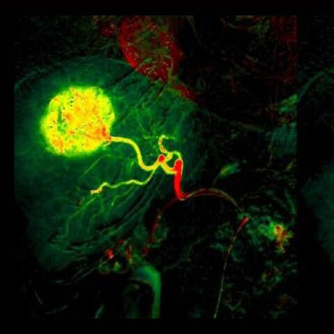 Oncology imaging