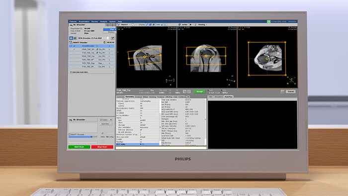 Planning scanning