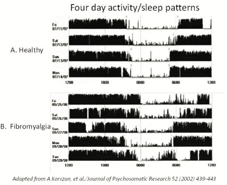 Fibromyalgia study data activity level chart