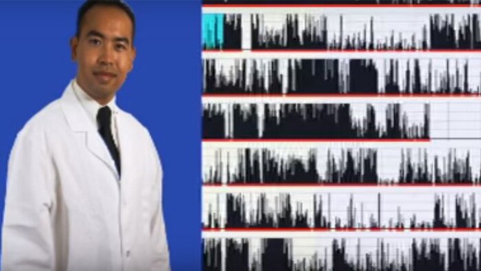 Improve Confidence in MSLT Interpretation