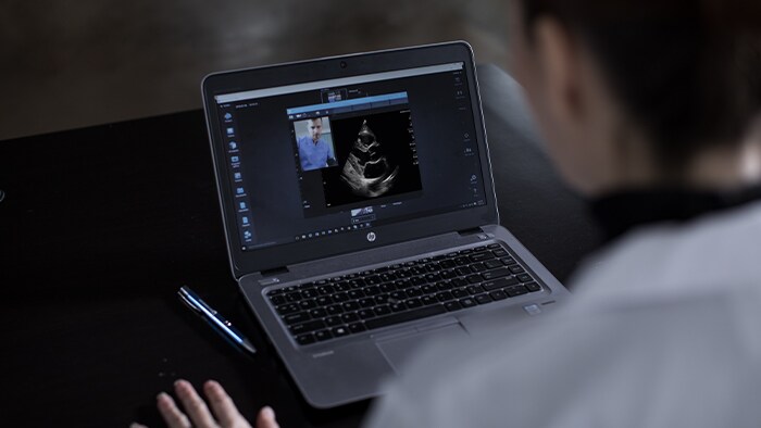 Person in labcoat having a video conference with another person while looking at scans on a monitor