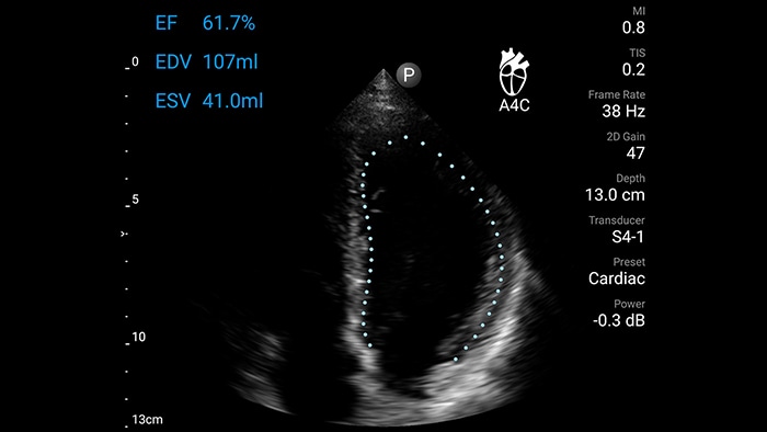 Lumify compatible with Apple devices new ef