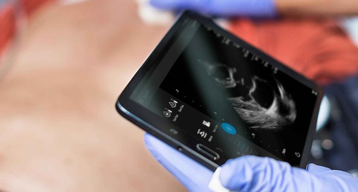 Personal ultrasound machine for office practice