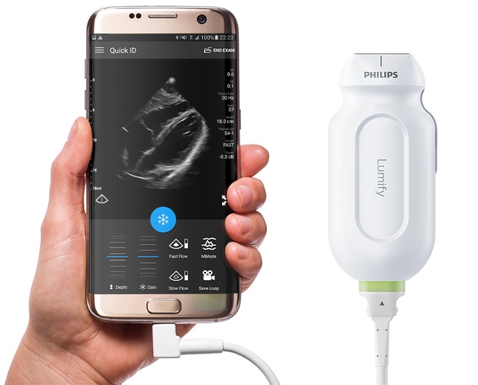 Image Result For I Smartphone Ultrasound Image Result For I Smartphone Ultrasound