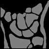 ingenia-1.5T-wrist