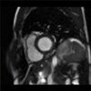 tips-for-cardiac-mr