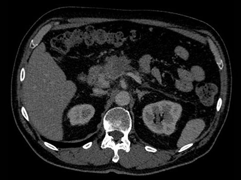 IQon Spectral CT image