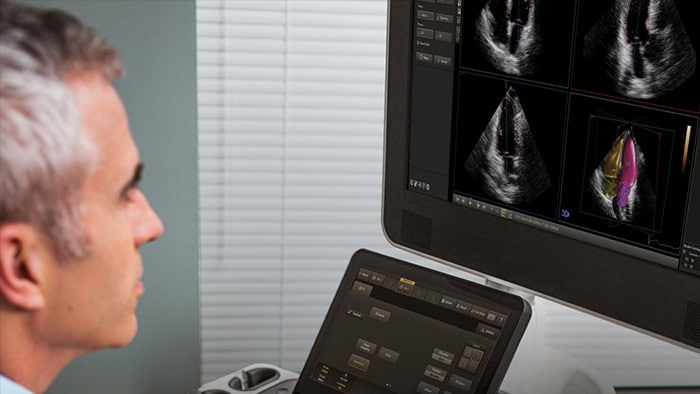 Anatomical intelligence in Philips ultrasound machines