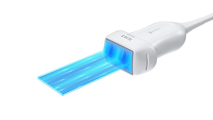 The Philips XL14-3 xMATRIX linear array transducer vascular ultrasound