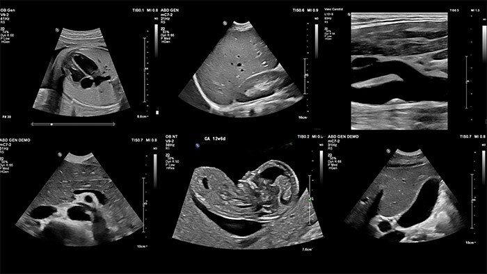 XRES PRO Ultrasound imaging