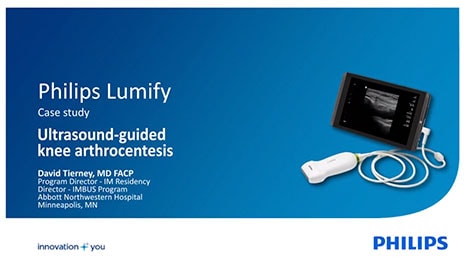 philips lumify case study - video