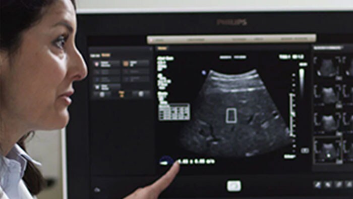 Shear Wave Ultrasound Liver Assessment