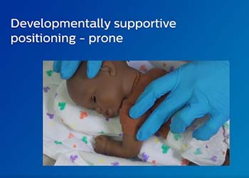 Infant Positioning Flexible Stable Support Philips
