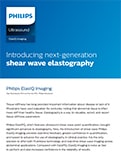 shear wave image
