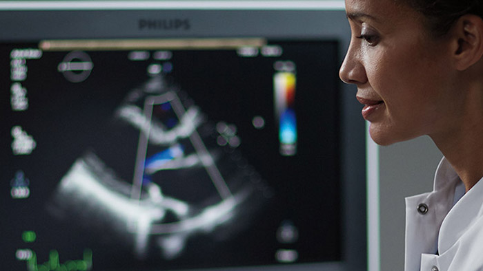 Seamless integrated cardiology solutions