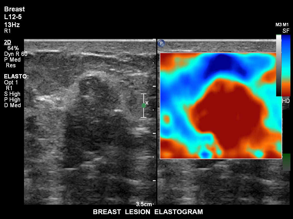 ultrasound first trimester image clinical