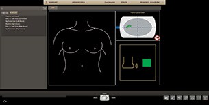 Philips AI Breast transducer registration display