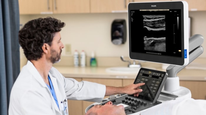 EPIQ Ultrasound