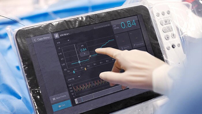 Flexible radiology workflow