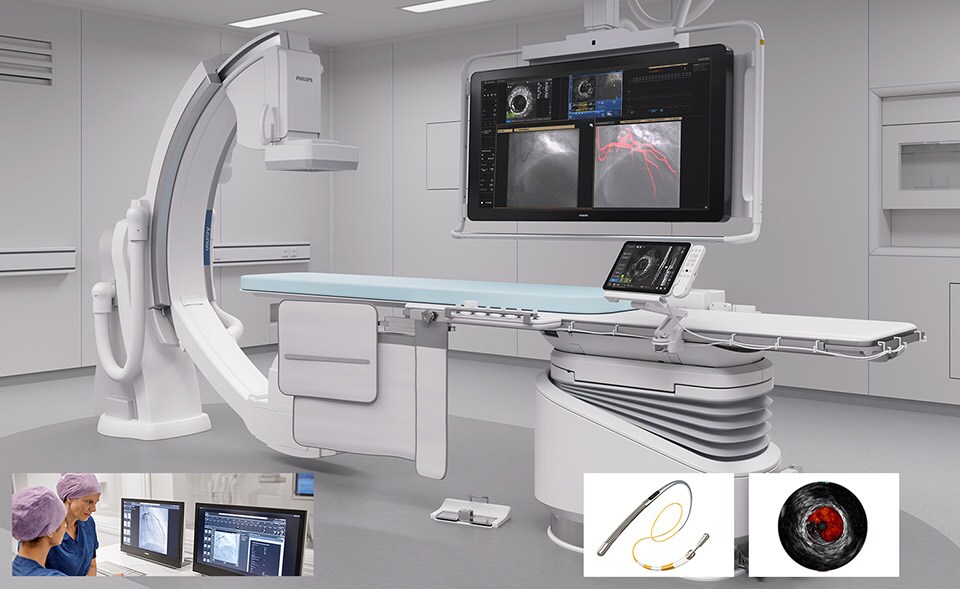 CAD treatment hotspot section