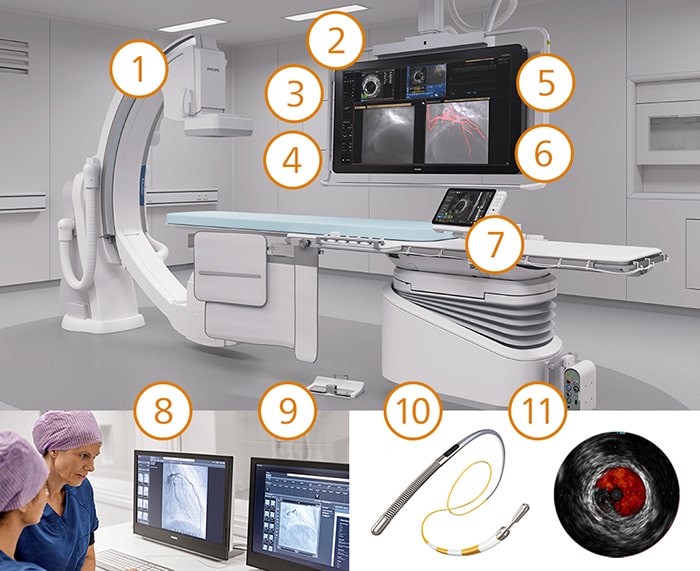 CAD treatment hotspot mobile