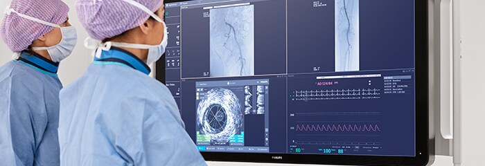 Medical professionals watching screen for procedure